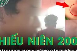Thiếu niên bị cha dượng đốt 'vùng kín': Vì quá hoảng sợ nên không dám nói sự thật