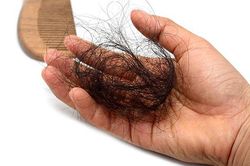 Vì sao người trẻ tuổi lại bị rụng tóc nhiều?