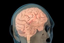 Ứng dụng AI cải thiện trí nhớ cho bệnh nhân bị chấn thương sọ não