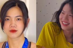 Ánh Viên lên tiếng về tin đồn phẫu thuật thẩm mỹ