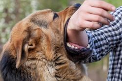 Bé gái ở Nghệ An bị chó cắn rách vùng mặt và đầu