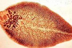 Nhiễm bệnh sán lá gan lớn do ăn rau sống