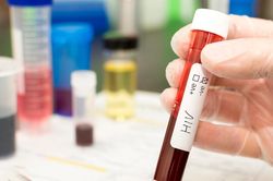Người thứ 6 trên thế giới khỏi HIV