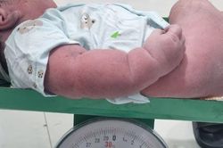 Hy hữu sản phụ sinh thường bé trai nặng 5kg