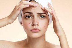 Trị mụn nhọt dễ dàng bằng cây lá trong vườn nhà