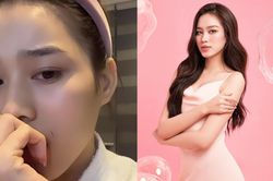 Hoa hậu Đỗ Thị Hà vô tình tự tạo vết thương trên má, để lộ biểu cảm hoang mang