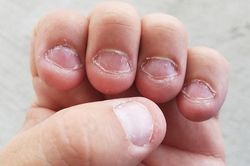 Làm thế nào để bỏ tật cắn móng tay?