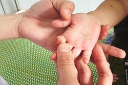 12/13 huyện, thị của Quảng Ngãi ghi nhận ca tay chân miệng