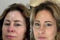 Quý bà 50 tuổi bán nhà để phẫu thuật thẩm mỹ lấy lại tuổi xuân