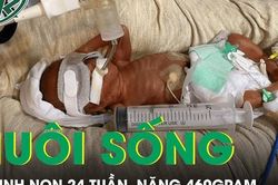 Kỳ tích nuôi sống bé sinh non 24 tuần tuổi, nặng 460 gram