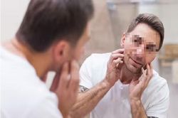 Triệu chứng ung thư chết người có thể phát hiện khi soi gương