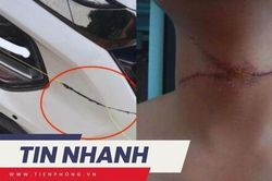 TIN NHANH 12H: Chuyên gia nói về sáp nhập quận Hoàn Kiếm; Dây diều cứa ngang cổ người, chém đầu ô tô