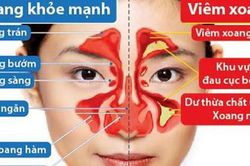 Thực dưỡng cho người bệnh viêm xoang