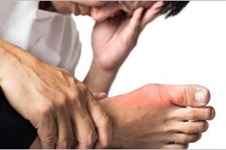 Vì sao bệnh gout dễ kèm theo gan nhiễm mỡ?