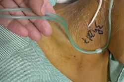 Ăn xôi lấy màu từ cây, cỏ không nguồn gốc, nam thanh niên bị ngộ độc