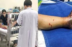 Tìm nguồn huyết thanh khắp trong, ngoài nước cứu 3 trẻ bị rắn độc cắn