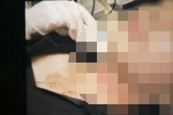 Bình Dương: Xử lý vụ cô gái tự cắt cổ rồi báo bị tấn công, cướp tài sản