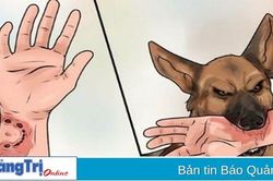 Bé trai tử vong nghi do mắc bệnh dại