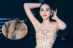 Đỗ Thị Hà đăng tải ảnh thân thể trầy xước trong đêm khiến fan xót xa