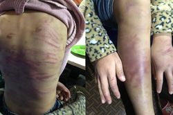 Hà Nội: Đề xuất hỗ trợ trẻ em bị bạo lực nghiêm trọng 11 triệu đồng/trẻ