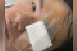 Công an mời thanh niên nghi bị CSGT dùng gậy 'tác động' lên làm việc