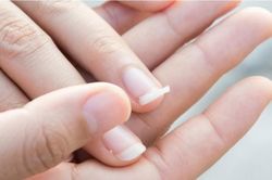 Dấu hiệu cảnh báo cơ thể bị nhiễm độc