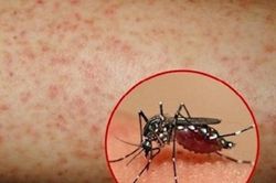 Thêm một trẻ 13 tuổi ở Đắk Lắk tử vong do mắc sốt xuất huyết
