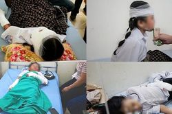 Nguyên nhân bất ngờ vụ bóng bay phát nổ trong ngày khai giảng khiến 10 học sinh bị bỏng