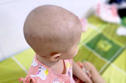 Nguy cơ đột quỵ và suy tim ở người bệnh ung thư