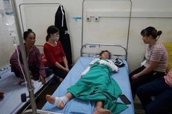 Nguyên nhân khiến bóng bay phát nổ làm nhiều học sinh bị bỏng
