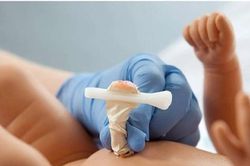 Bệnh viện Sản Nhi Nghệ An cứu sống trẻ sơ sinh bị uốn ván rốn nguy hiểm