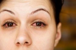 Bệnh đau mắt đỏ và cách phòng chống