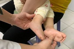6 biện pháp phòng bệnh tay chân miệng khi vào năm học mới
