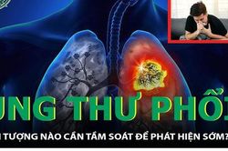 6 thói quen giúp nâng cao sức khỏe cho người đang điều trị ung thư phổi