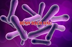 Bệnh bạch hầu diễn biến phức tạp, 3 ca tử vong
