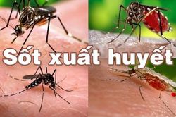 Nguyên nhân khiến dịch sốt xuất huyết diễn biến phức tạp
