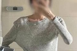49kg bị chê béo, nữ sinh nhịn ăn giảm cân...kết đau lòng