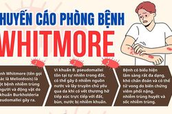 Khuyến cáo phòng bệnh Whitmore