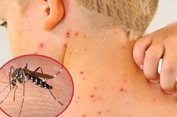Cả nước có hơn 87.000 ca sốt xuất huyết, nhiều trường hợp đến viện đã nặng