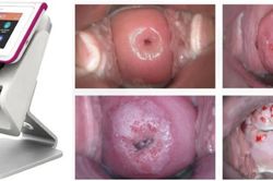 Thành phố Hồ Chí Minh ứng dụng AI trong lĩnh vực sản phụ khoa
