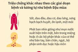 Bệnh Đậu mùa Khỉ: Triệu chứng và các biện pháp phòng bệnh