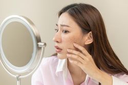 Dị ứng mỹ phẩm: Câu chuyện phổ biến mà các nàng thường né tránh