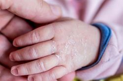 Cảnh báo tình trạng trẻ thiếu chất có thể ảnh hưởng đến khả năng học tập