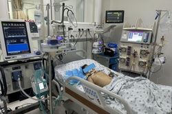 2 trẻ suy đa tạng do ong đốt