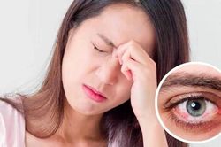 Dịch đau mắt đỏ diễn biến 'căng thẳng': Bác sĩ khuyến cáo 6 'Không'