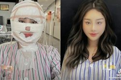Lâm Khánh Chi ngầm xác nhận việc 'dao kéo', netizen xót xa thay cho nữ ca sĩ