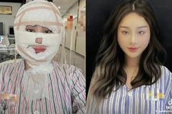 Khó nhận ra Lâm Khánh Chi sau màn 'dao kéo' mới nhất