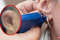 Cảnh báo biến chứng nguy hiểm do bấm lỗ tai sai vị trí