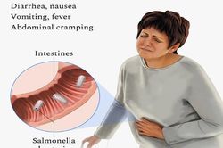 Triệu chứng nhiễm khuẩn Salmonella dễ nhầm lẫn