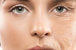 3 loại phẫu thuật xóa nếp nhăn, trẻ hóa khuôn mặt cần biết